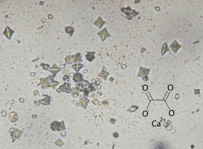 cristalli di ossalato di calcio calcoli del gatto